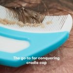 The 3-Step Cradle Cap System by Fridababy | DermaFrida the FlakeFixer | Sponge, Brush, Comb and Storage Stand for Babies with Cradle Cap - Image 6